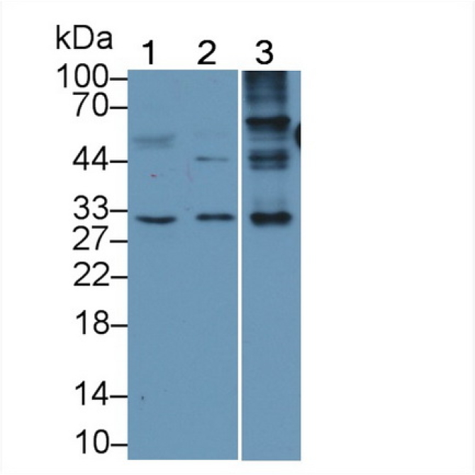 Major Basic Protein (MBP) Human Monoclonal Antibody