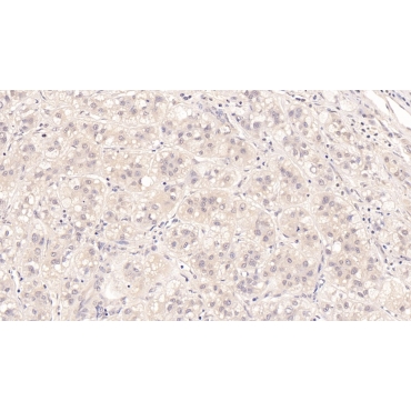 Major Basic Protein (MBP) Human Monoclonal Antibody