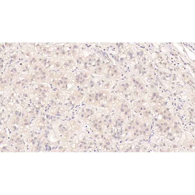 Major Basic Protein (MBP) Human Monoclonal Antibody