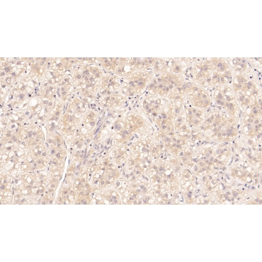 Major Basic Protein (MBP) Human Monoclonal Antibody