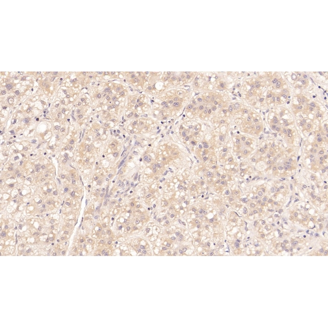 Major Basic Protein (MBP) Human Monoclonal Antibody
