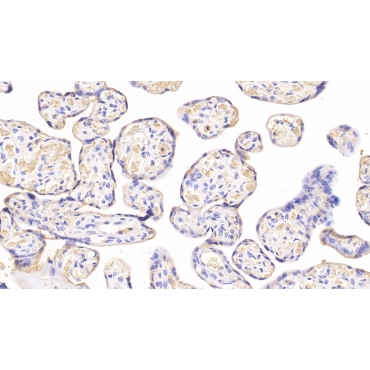 Major Basic Protein (MBP) Human Monoclonal Antibody