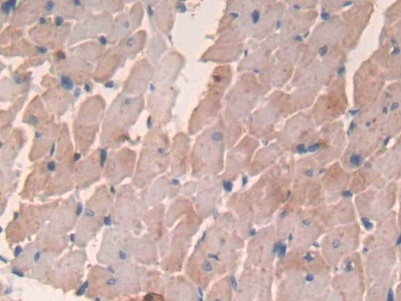 Major Basic Protein (MBP) Rat Monoclonal Antibody