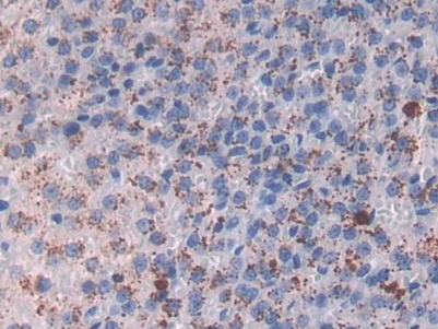 Major Basic Protein (MBP) Rat Monoclonal Antibody