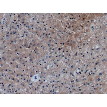 Chemokine (C-X-C Motif) Ligand 27 (CCL27) Human Monoclonal Antibody