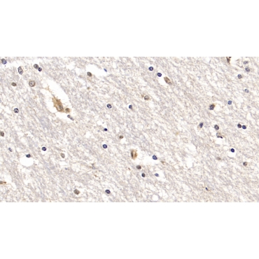 Interleukin 18 Receptor 1 (IL18R1) Human Monoclonal Antibody