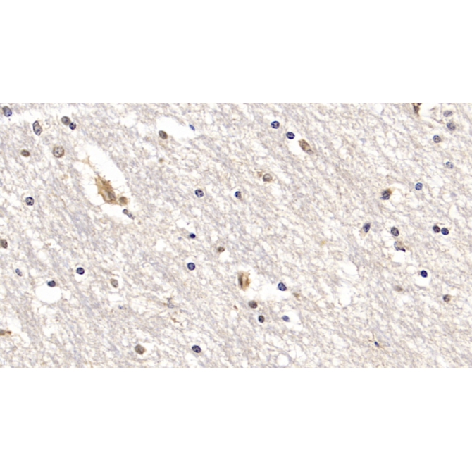Interleukin 18 Receptor 1 (IL18R1) Human Monoclonal Antibody