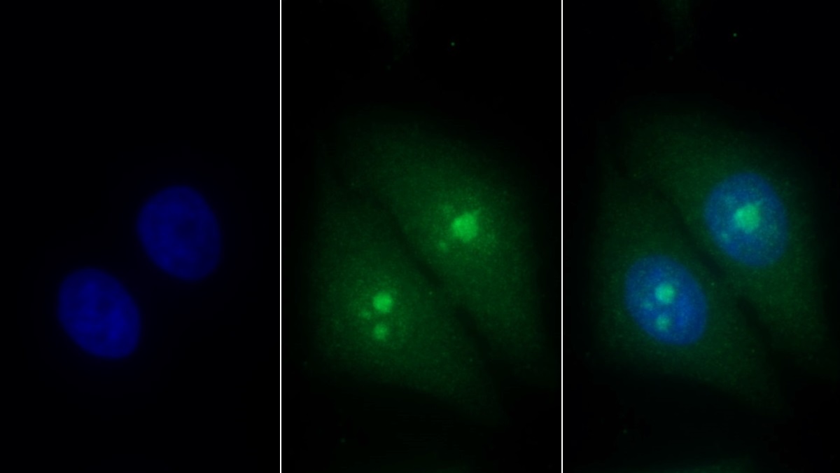 Trefoil Factor 3 (TFF3) Human Monoclonal Antibody