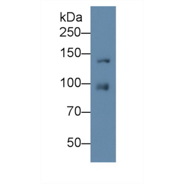 Insulin Like Growth Factor 1 Receptor (IGF1R) Human Monoclonal Antibody