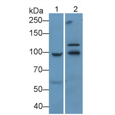 Insulin Like Growth Factor 1 Receptor (IGF1R) Human Monoclonal Antibody