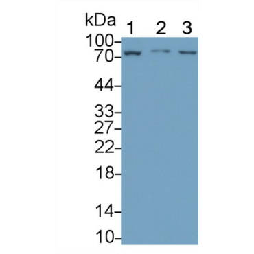 Lymphocyte Activation Gene 3 (LAG3) Human Monoclonal Antibody