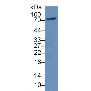 Lymphocyte Activation Gene 3 (LAG3) Human Monoclonal Antibody