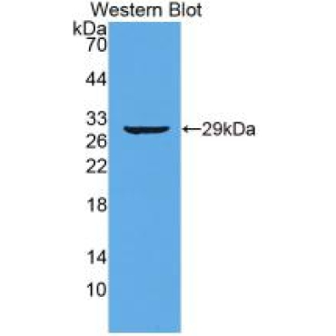 Titin (TTN) Human Monoclonal Antibody