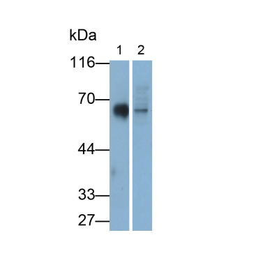 Cluster Of Differentiation 226 (CD226) Human Monoclonal Antibody