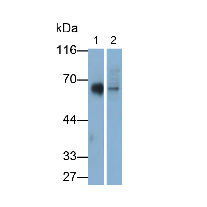 Cluster Of Differentiation 226 (CD226) Human Monoclonal Antibody