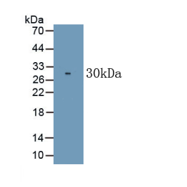 Cluster Of Differentiation 226 (CD226) Human Monoclonal Antibody