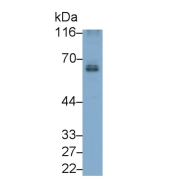 Cluster Of Differentiation 226 (CD226) Human Monoclonal Antibody