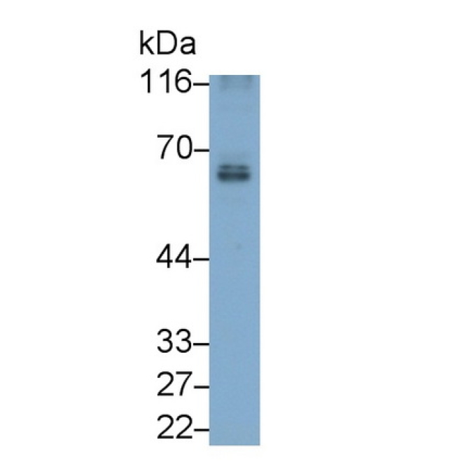 Cluster Of Differentiation 226 (CD226) Human Monoclonal Antibody