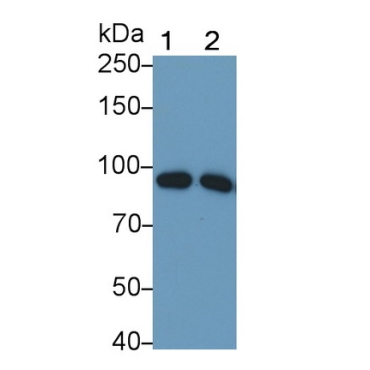Complement Component 1, S Subcomponent (C1s) Human Monoclonal Antibody