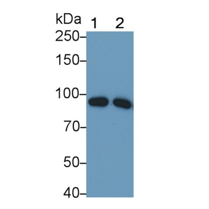 Complement Component 1, S Subcomponent (C1s) Human Monoclonal Antibody