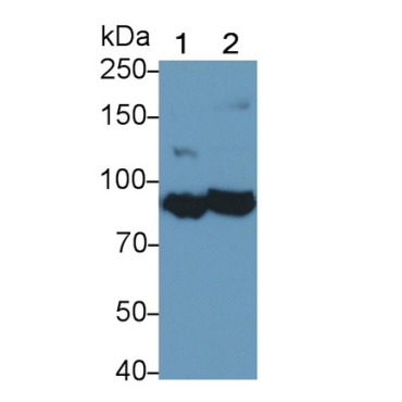 Complement Component 1, S Subcomponent (C1s) Human Monoclonal Antibody