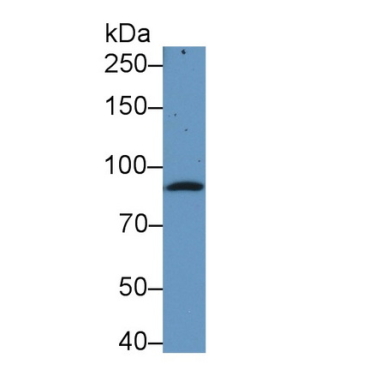 Complement Component 1, S Subcomponent (C1s) Human Monoclonal Antibody
