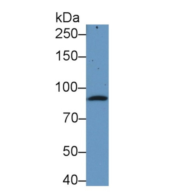 Complement Component 1, S Subcomponent (C1s) Human Monoclonal Antibody