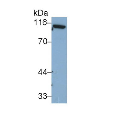 Complement Component 1, S Subcomponent (C1s) Human Monoclonal Antibody
