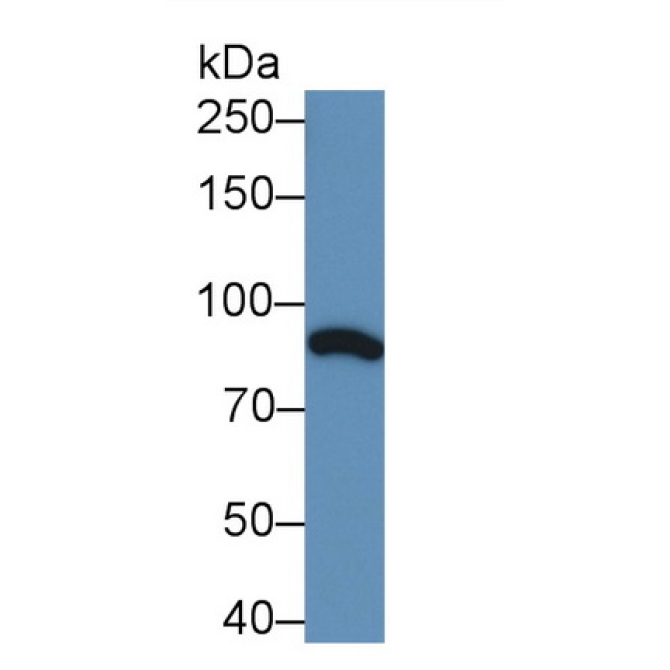 Complement Component 1, S Subcomponent (C1s) Human Monoclonal Antibody