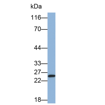 Integrin Alpha M (CD11b) Human Monoclonal Antibody