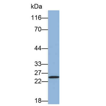 Integrin Alpha M (CD11b) Human Monoclonal Antibody