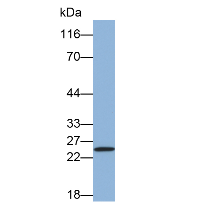 Integrin Alpha M (CD11b) Human Monoclonal Antibody