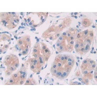 Interleukin 28A (IL28A) Human Monoclonal Antibody