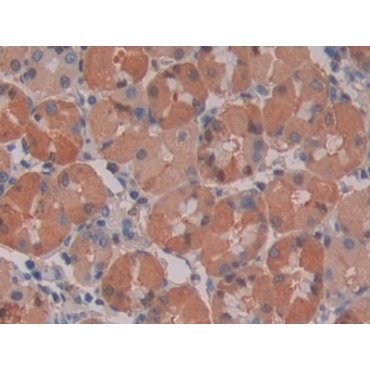 Interleukin 28A (IL28A) Human Monoclonal Antibody