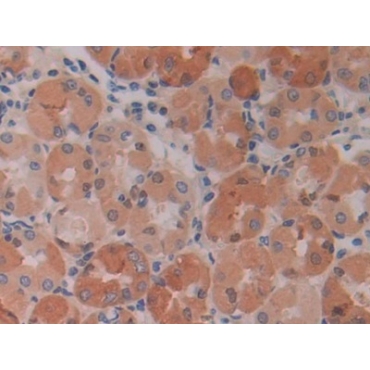 Interleukin 28A (IL28A) Human Monoclonal Antibody
