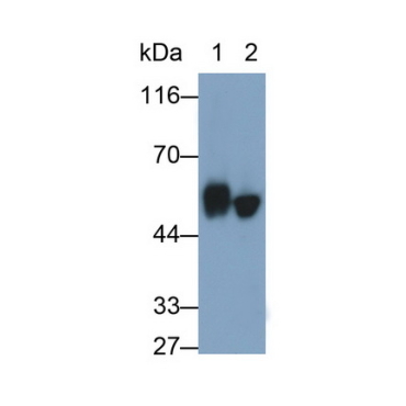 Cytokeratin 10 (CK10) Human Monoclonal Antibody