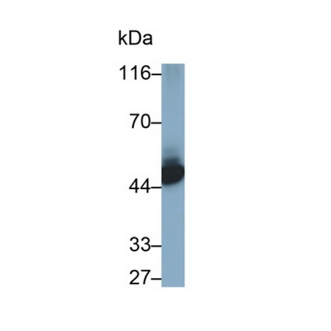 Cytokeratin 10 (CK10) Human Monoclonal Antibody