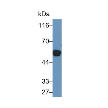 Cytokeratin 10 (CK10) Human Monoclonal Antibody