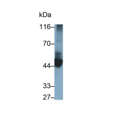 Cytokeratin 10 (CK10) Human Monoclonal Antibody
