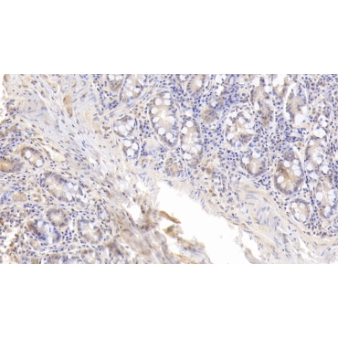Fatty Acid Binding Protein 4 (FABP4) Human Monoclonal Antibody