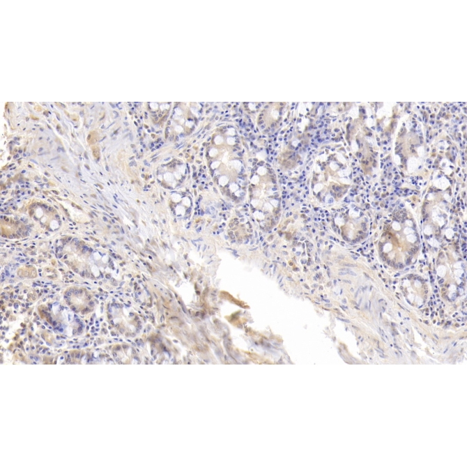 Fatty Acid Binding Protein 4 (FABP4) Human Monoclonal Antibody