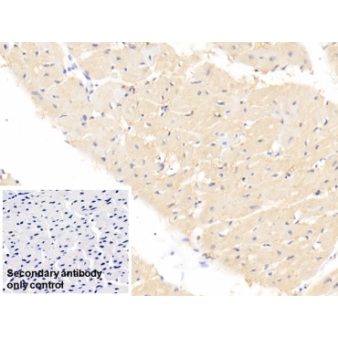Fatty Acid Binding Protein 4 (FABP4) Human Monoclonal Antibody