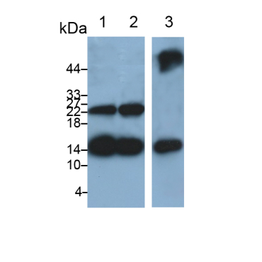 Fatty Acid Binding Protein 4 (FABP4) Human Monoclonal Antibody