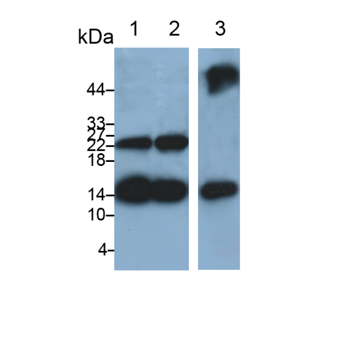 Fatty Acid Binding Protein 4 (FABP4) Human Monoclonal Antibody