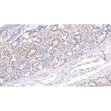 Fatty Acid Binding Protein 4 (FABP4) Human Monoclonal Antibody