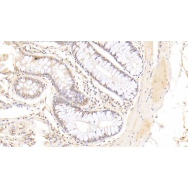Fatty Acid Binding Protein 4 (FABP4) Human Monoclonal Antibody