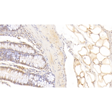 Fatty Acid Binding Protein 4 (FABP4) Human Monoclonal Antibody