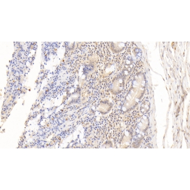 Fatty Acid Binding Protein 4 (FABP4) Human Monoclonal Antibody