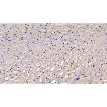 Vascular Endothelial Growth Factor 165 (VEGF165) Human Monoclonal Antibody