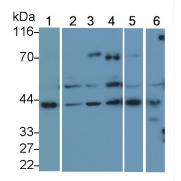 Vascular Endothelial Growth Factor 165 (VEGF165) Human Monoclonal Antibody